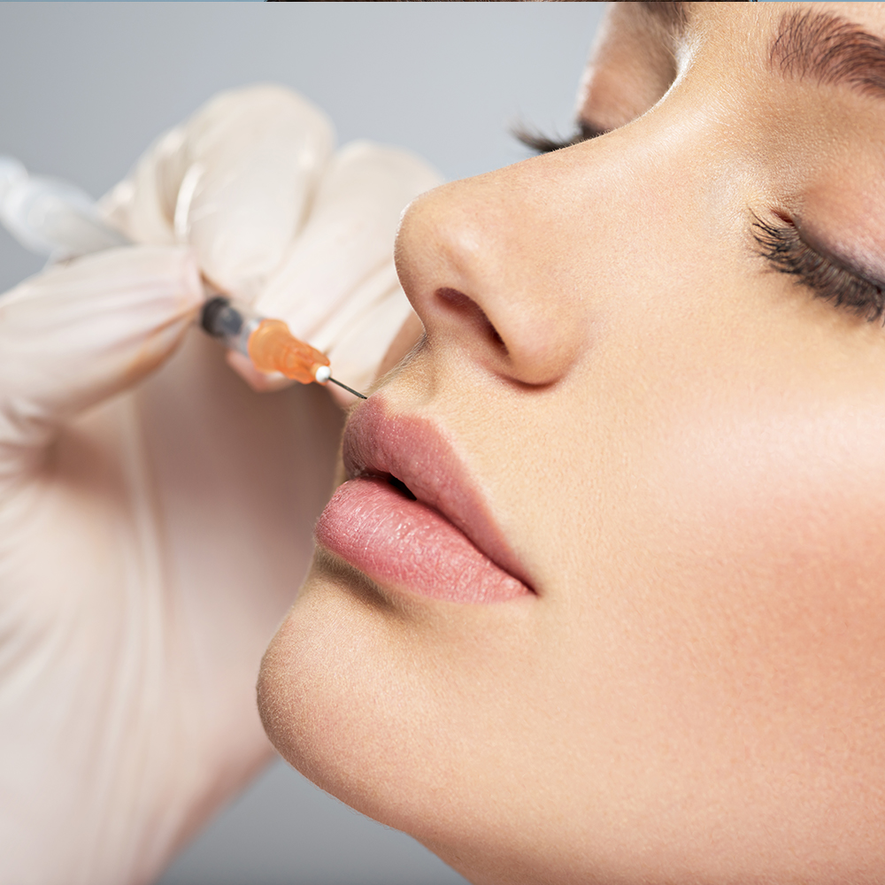 Erase Time: Discover the Power of Dermal Fillers at Ubest